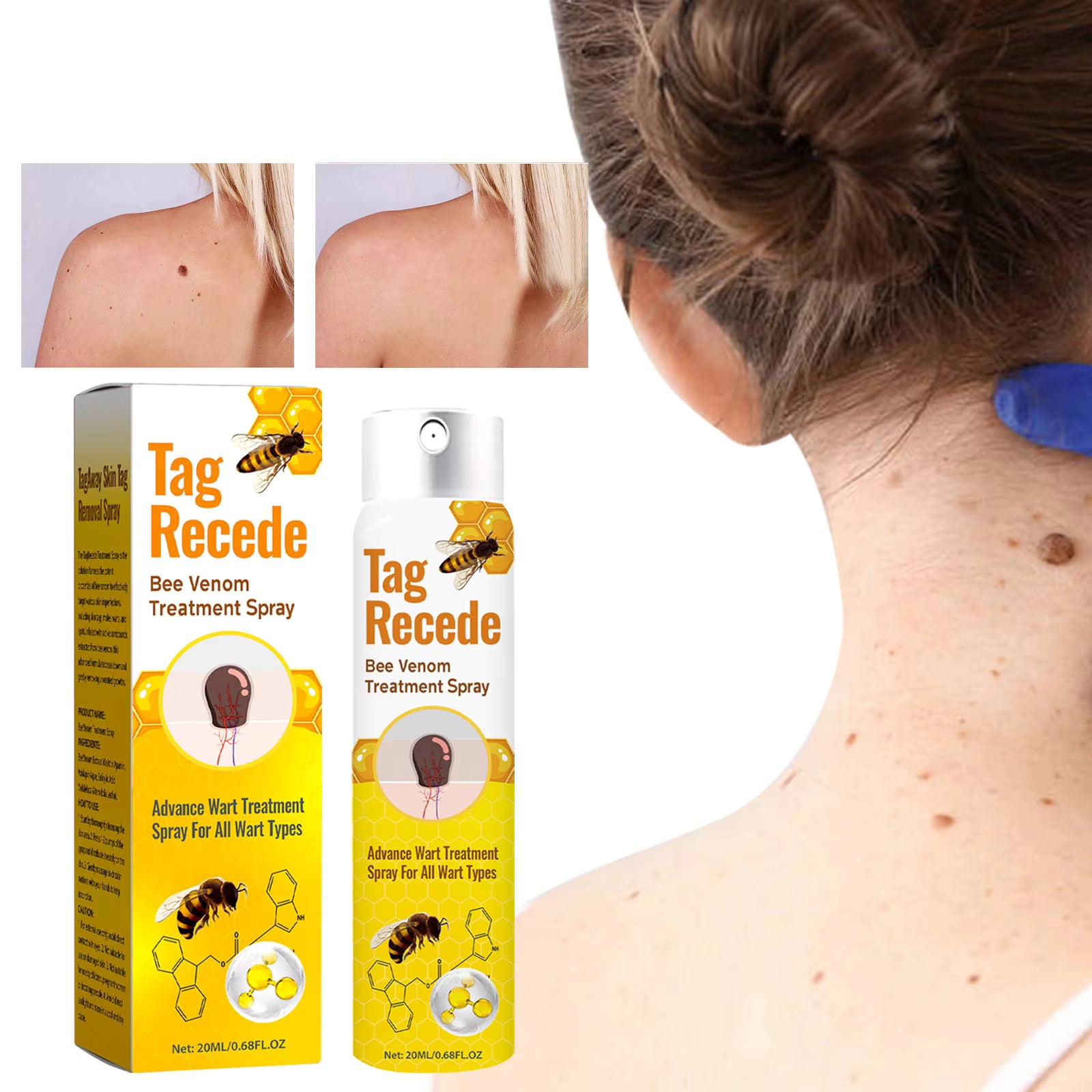 Tag Recede Bee Venom Repair Spray – Advanced Skin Care Spray for Smooth Skin & Tag Relief – Gentle Exfoliating Formula