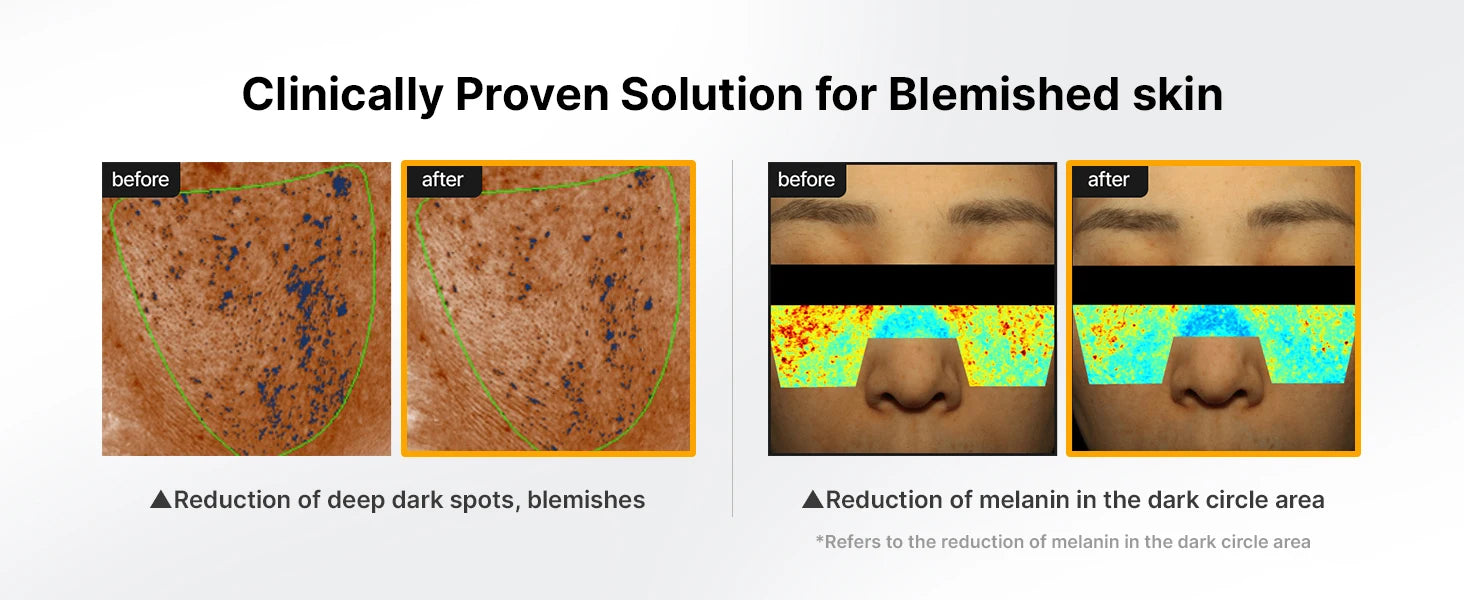 CeliMax Pore & Dark Spot Brightening Cream – Advanced Skin Tone Corrector, Spot Reduction & Pore Refining Formula